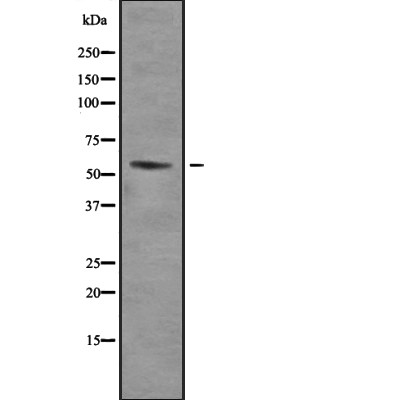 THR alpha Antibody - Western blot analysis of TRalpha using SKOV3 whole cell lysates.