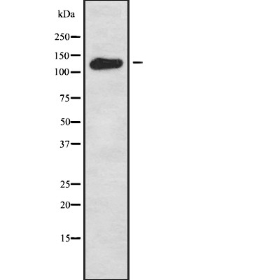 WDHD1 Antibody - Western blot analysis of WDHD1 using HeLa whole cell lysates.