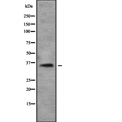 ZIP2 Antibody - Western blot analysis of ZIP2 using Jurkat whole cell lysates.