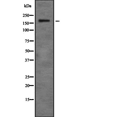 ZNF262 Antibody - Western blot analysis of ZNF262 using HepG2 whole cell lysates.
