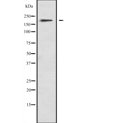MYO1F Antibody - Western blot analysis of MYO1F expression in  A673 lysates.