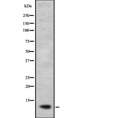 NDUFB2 Antibody - Western blot analysis of NDUFB2 expression in  A673 lysate.