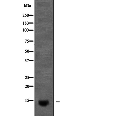 KCNE2 Antibody - Western blot analysis of KCNE2 expression in Pancreas (Mouse) Tissue Lysate .