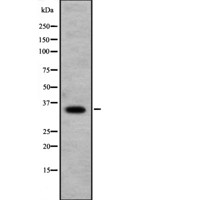 RFPL1 Antibody - Western blot analysis of RFPL1 expression in  Jurkat cell lysates.
