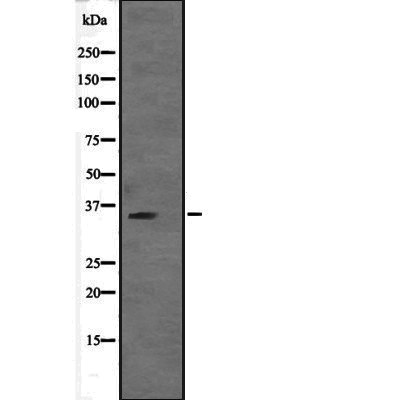 VGLL2 Antibody - Western blot analysis of VGLL2 expression in  VGLL2 transfected 293T cell lysates.