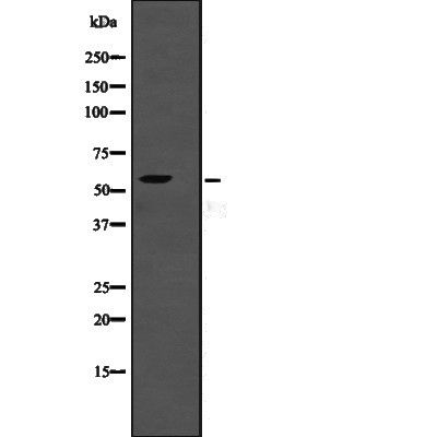 TSEN2 Antibody - Western blot analysis of TSEN2 expression in  TSEN2 transfected 293T lysates.