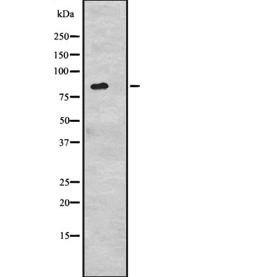 CDH6 Antibody - Western blot analysis of CDH6 expression in  293 cell lysates .