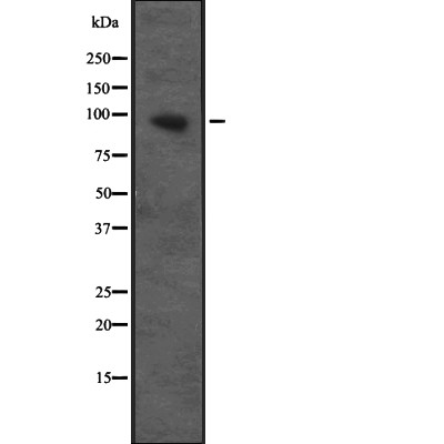 CUL4B Antibody - Western blot analysis of CUL4B expression in Transfected 293T cell lysates.