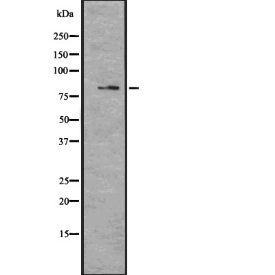 MAGD4 Antibody - Western blot analysis of MAGD4 expression in  U373 cell lysate.