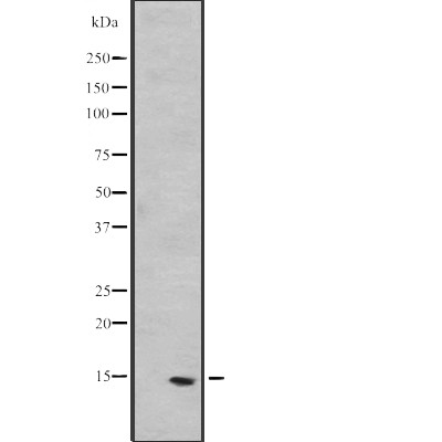 PEA15 Antibody - Western blot analysis of PEA15 expression in  T47D cell lysates .