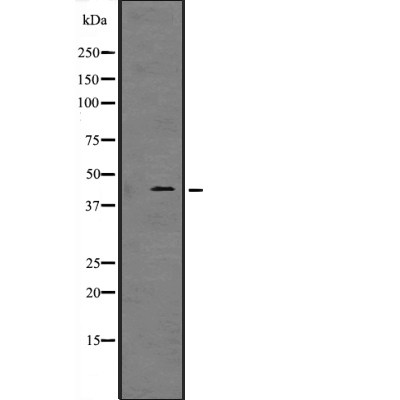 GFI1B Antibody - Western blot analysis of GFI1B expression in  Jurkat cell lysate.