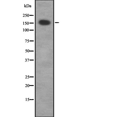 MRCKG Antibody - Western blot analysis of MRCKG expression in HEK293 cells .