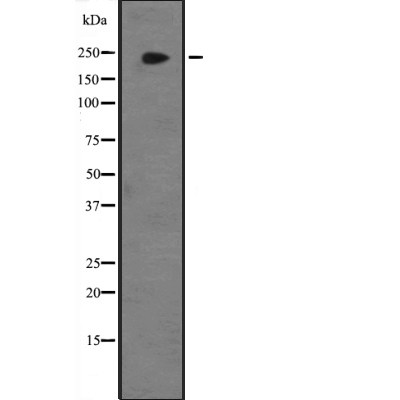 JMJD1B Antibody - Western blot analysis of JMJD1B expression in  Hela cell lysates.
