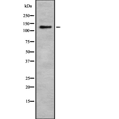 RB6I2 Antibody - Western blot analysis of RB6I2 expression in HEK293 cells .