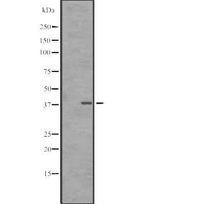SNAPC3 Antibody - Western blot analysis of SNAPC3 expression in A431 whole cell lysates .