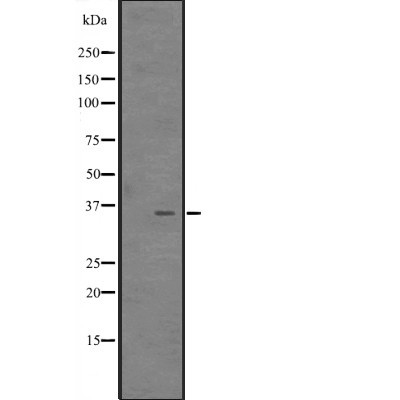 CITED4 Antibody - Western blot analysis of CITED4 expression in  MCF7 Cell Lysate .