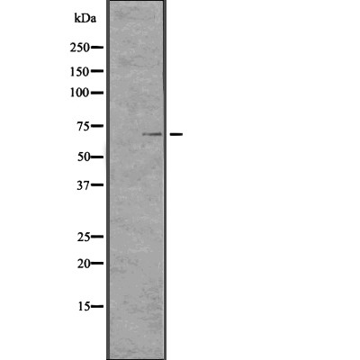 TCHP Antibody - Western blot analysis of TCHP expression in  CEM cell lysates .