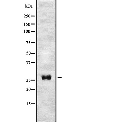 T106C Antibody - Western blot analysis of T106C expression in HEK293 cells .