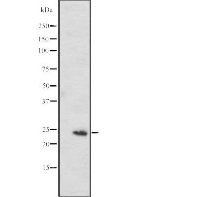 MED20 Antibody - Western blot analysis of MED20 expression in  RPMI-8226 cell lysates .