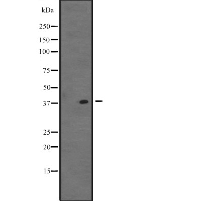 VSX1 Antibody - Western blot analysis of VSX1 expression in  K562 cell lysates .