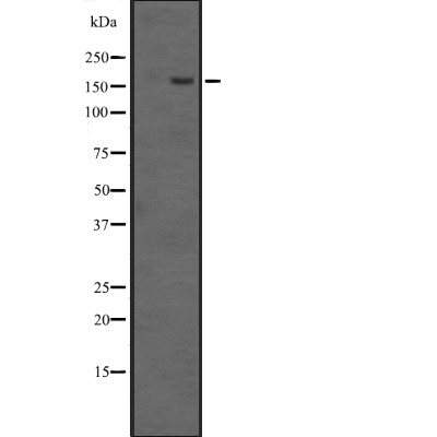 EHMT1 Antibody - Western blot analysis of EHMT1 expression in ; HepG2 cell lysates.