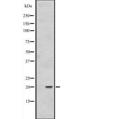 FAIM1 Antibody - Western blot analysis of FAIM1 expression in  293T whole cell lysates .