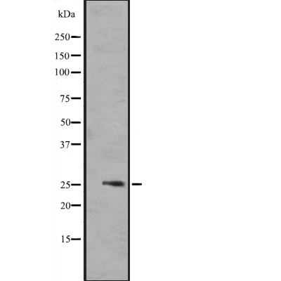 FGF17 Antibody - Western blot analysis of FGF17 expression in  721_B cell lysates .