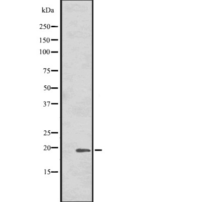 HSPB7 Antibody - Western blot analysis of HSPB7 expression in  Human fetal heart cell lysates .