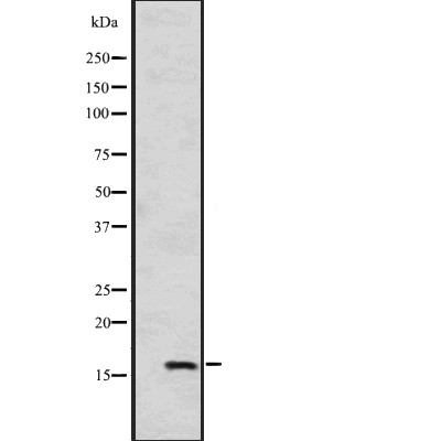 HSPB9 Antibody - Western blot analysis of HSPB9 transfected into  A549 cells.