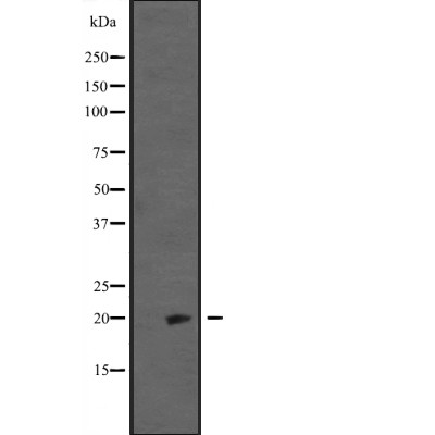 IGF2 Antibody - Western blot analysis of IGF2 expression in  Hela cell lysates.