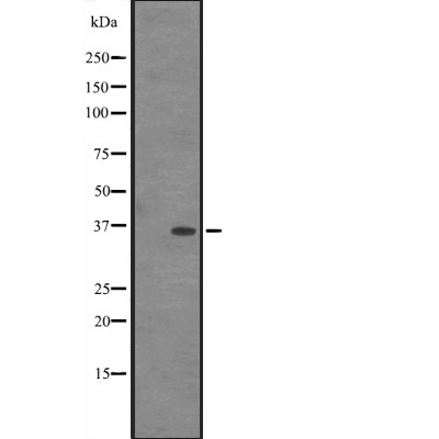 IN35 Antibody - Western blot analysis of IN35 expression in HEK293 cells .