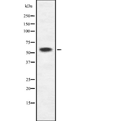 K2C6B/C Antibody - Western blot analysis of K2C6B/C expression in HEK293 cells .