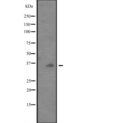 PDCD1LG2 Antibody - Western blot analysis of PDCD1LG2 expression in  ZR-75-1 cell lysates .