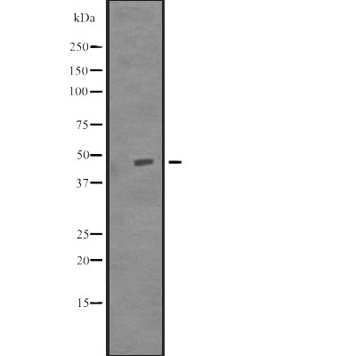 TUBD1 Antibody - Western blot analysis of TUBD1 expression in Delta 1 Tubulin transfected 293T cell lysates.