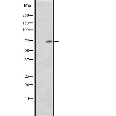 CNNM1 Antibody - Western blot analysis of CNNM1 expression in Human tonsil tissue lysates.