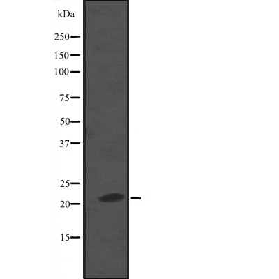 NKIRAS2 Antibody - Western blot analysis of NKIRAS2 expression in  A549 whole cell lysates .