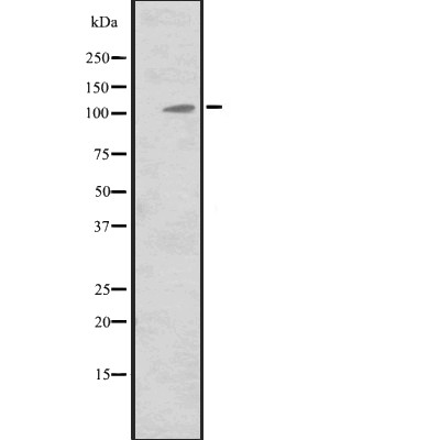 MIB2 Antibody - Western blot analysis of MIB2 expression in  Hela cell lysates.
