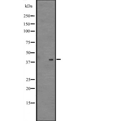 NDFIP2 Antibody - Western blot analysis of NDFIP2 expression in  721_B cell lysates .