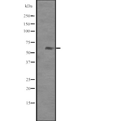 PAX8 Antibody - Western blot analysis of PAX8 expression in  Hela cell lysates.