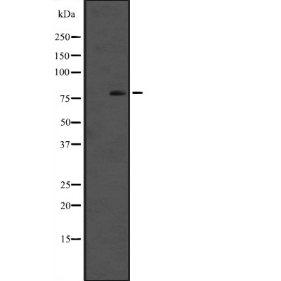 Cytochrome P450 reductase Antibody - Western blot analysis of Cytochrome P450 reductase expression in A431 whole cell lysates .