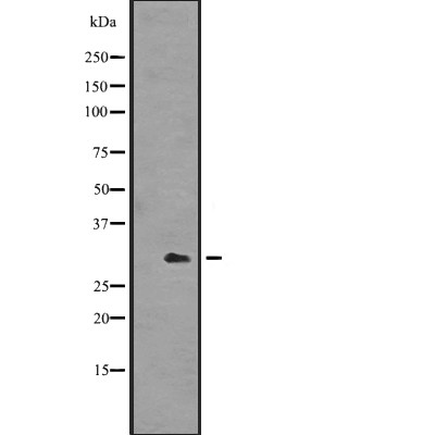 ING4 Antibody - Western blot analysis of ING4 expression in  A431 cell lysates .