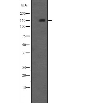 NRIP1 Antibody - Western blot analysis of NRIP1 expression in  A498 (Human Kidney Carcinoma) Whole Cell Lysate .