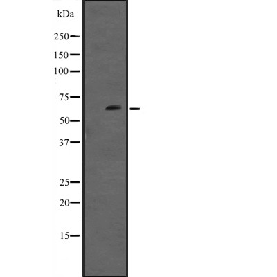 RIPK2 Antibody - Western blot analysis of RIPK2 expression in A431 whole cell lysates.