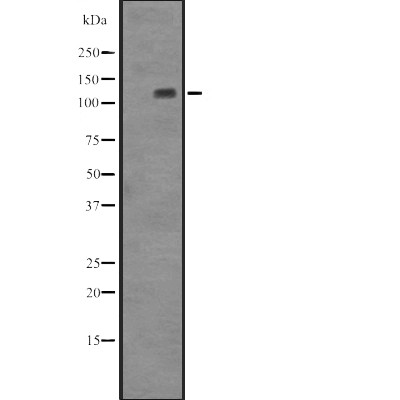 BUB1B Antibody - Western blot analysis of BUB1B expression in A431 whole cell lysates .