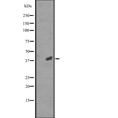 CDK20 Antibody - Western blot analysis of CCRK expression in  RPMI-8226 cell lysates ;.