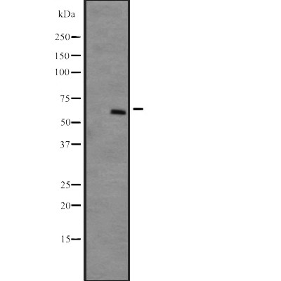 DYRK4 Antibody - Western blot analysis of DYRK4 expression in  NCI-H292 cell lysates ;developed using the ECL technique.