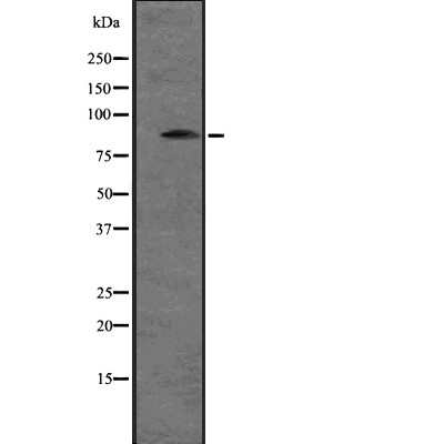 SNRK Antibody - Western blot analysis of SNRK expression in A431 whole cell lysates .