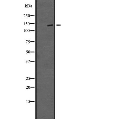 TTBK1 Antibody - Western blot analysis of TTBK1 expression in  Jurkat cell lysates .