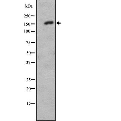 VEGFR3 Antibody - Western blot analysis of VEGFR3 expression in A431 whole cell lysates .