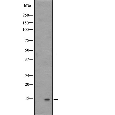 Histone H2B Antibody - Western blot analysis of Histone H2B expression in A431 whole cell lysates .